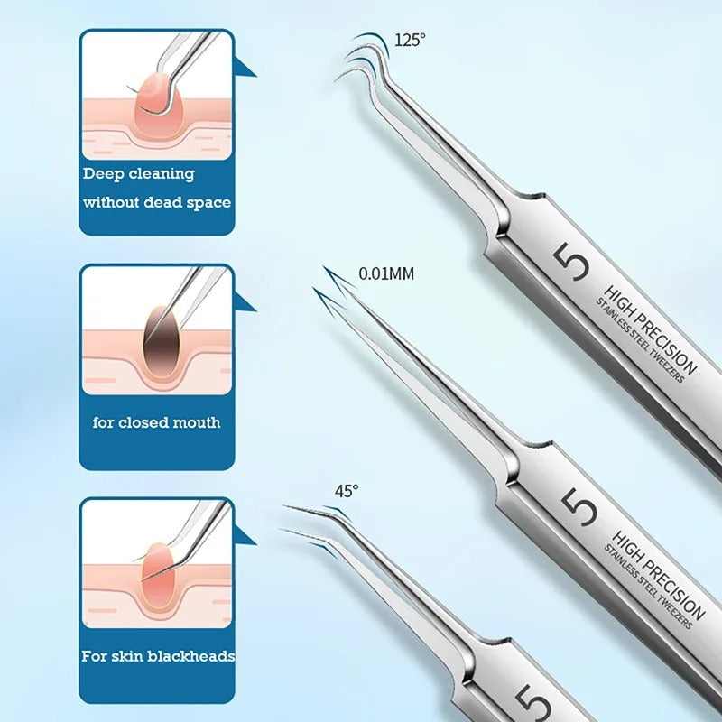 Pimple (whitehead/blackhead) Extraction Kit