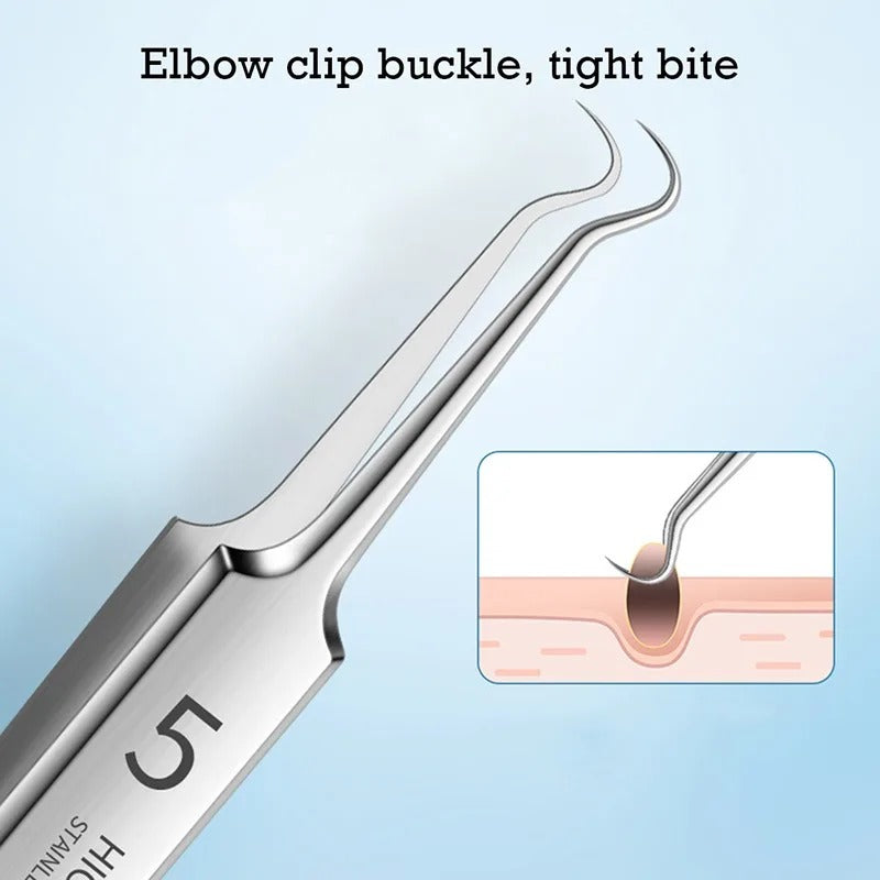 Pimple (whitehead/blackhead) Extraction Kit